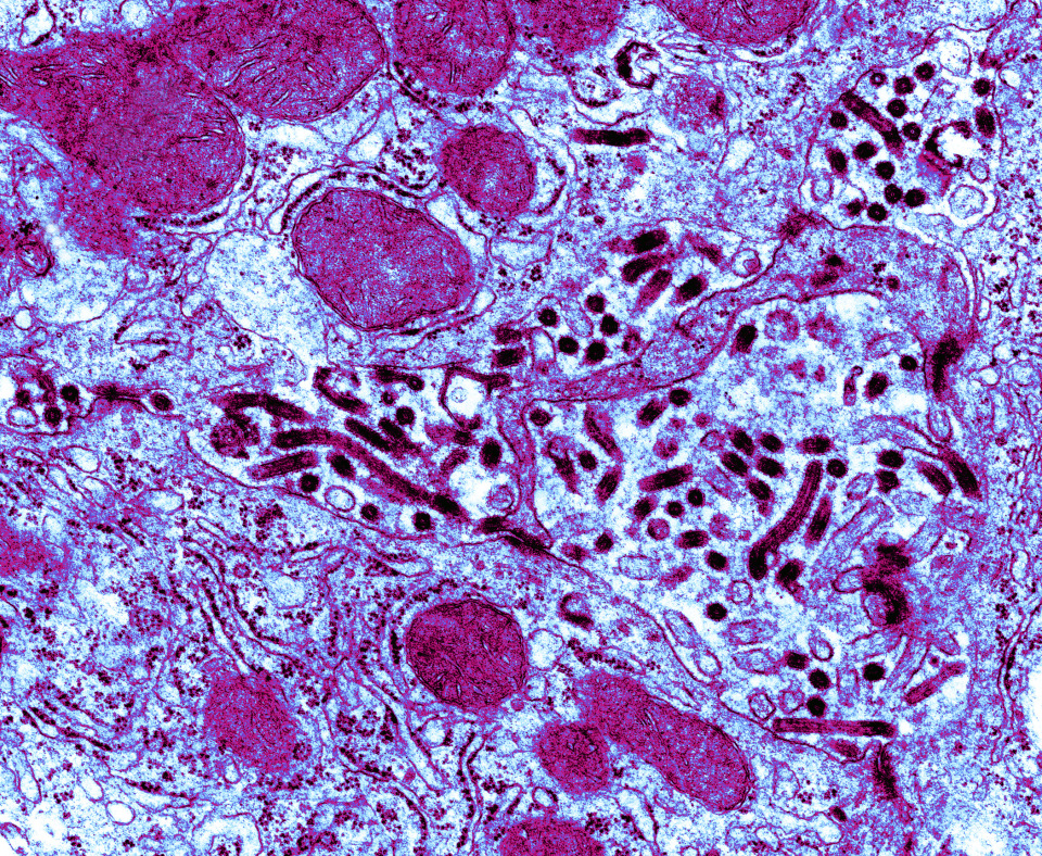 Marburg virus in liver colorized