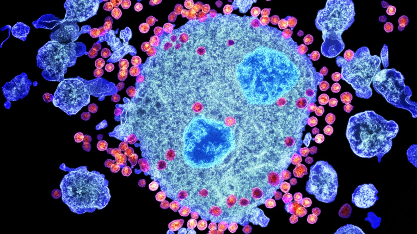 C0180126-Budding_HIV_particles_TEM-1600x900